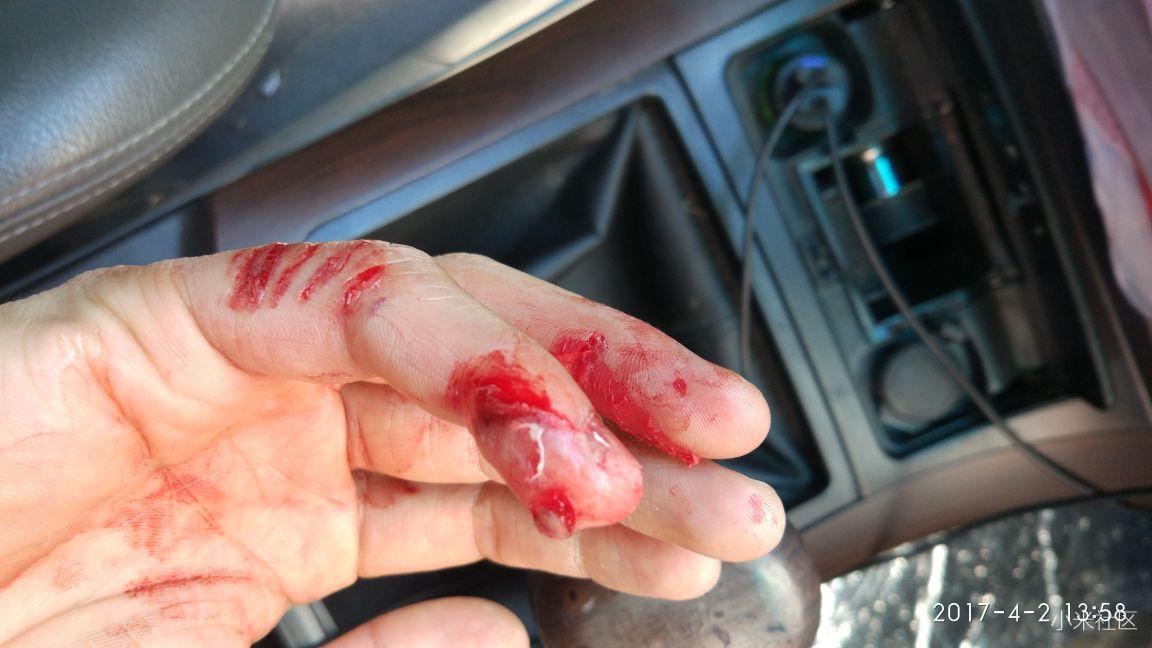 无人机打手后续