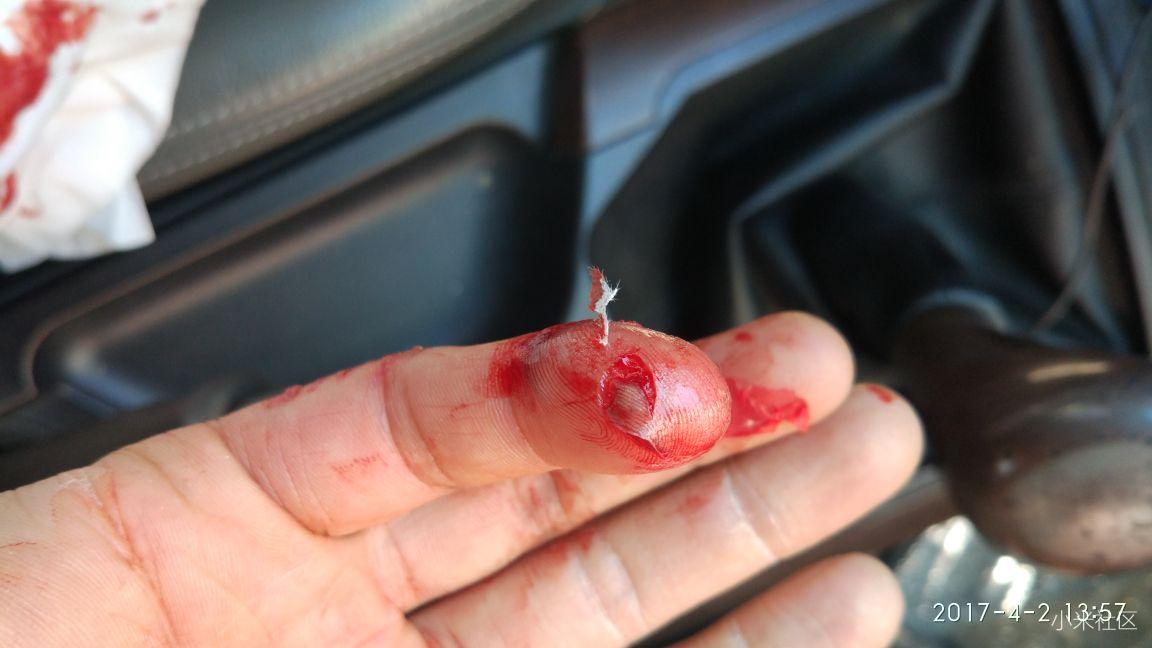 无人机打手后续